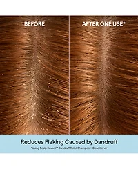 Briogeo Scalp Revival Dandruff Shampoo, 8.4 oz.