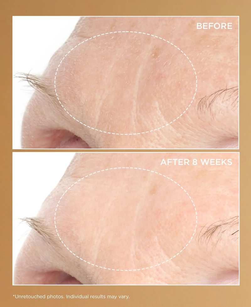 Perricone Md Neuropeptide Deep Crease Serum, 1 oz.