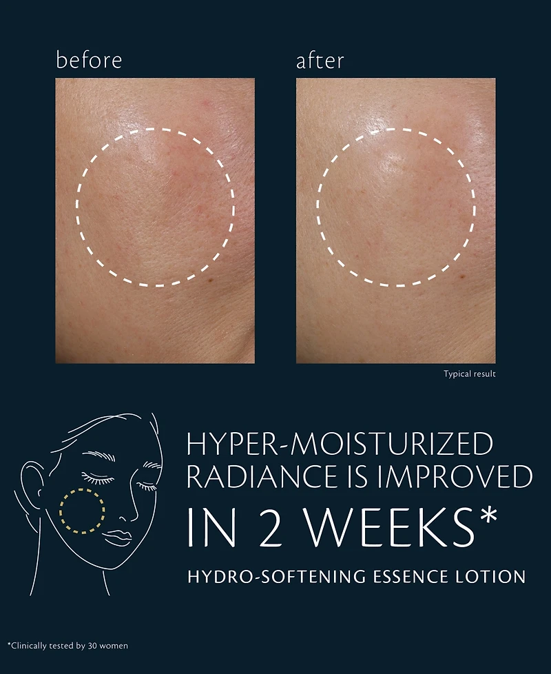 Cle de Peau Beaute Limited-Edition Hydro-Softening Essence Lotion, 8.45 oz.