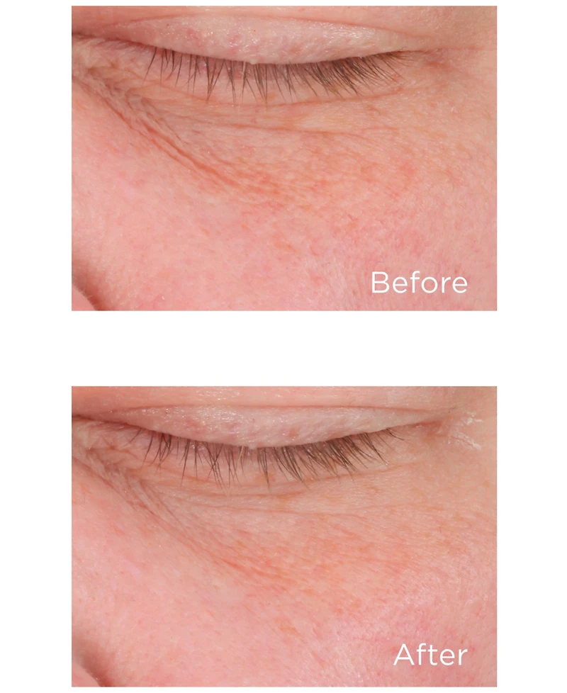Perricone Md Cold Plasma Plus+ Eye Advanced Eye Cream, 0.5-oz.