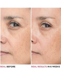 It Cosmetics Bye Bye Lines 1.5% Hyaluronic Acid Concentrated Derma Serum