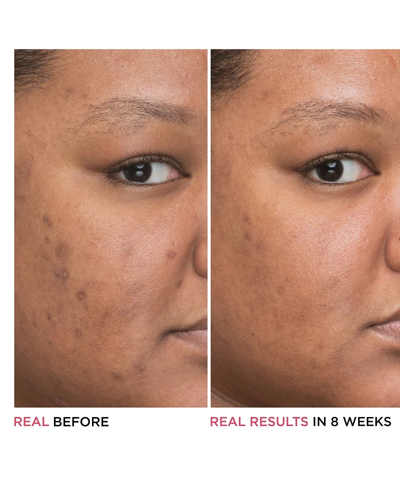 It Cosmetics Bye Bye Dark Spots 4% Niacinamide Concentrated Derma Serum