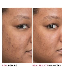 It Cosmetics Bye Bye Dark Spots 4% Niacinamide Concentrated Derma Serum