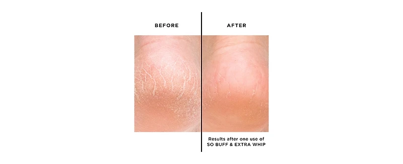butter London Jumbo Extra Whip Hand & Foot Treatment With Shea Butter, 7 oz.
