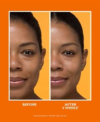 Peter Thomas Roth Potent-c Brightening Vitamin C Moisturizer, 1.7 oz.