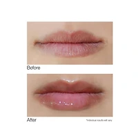 Dermelect Smooth Lip Volumizer