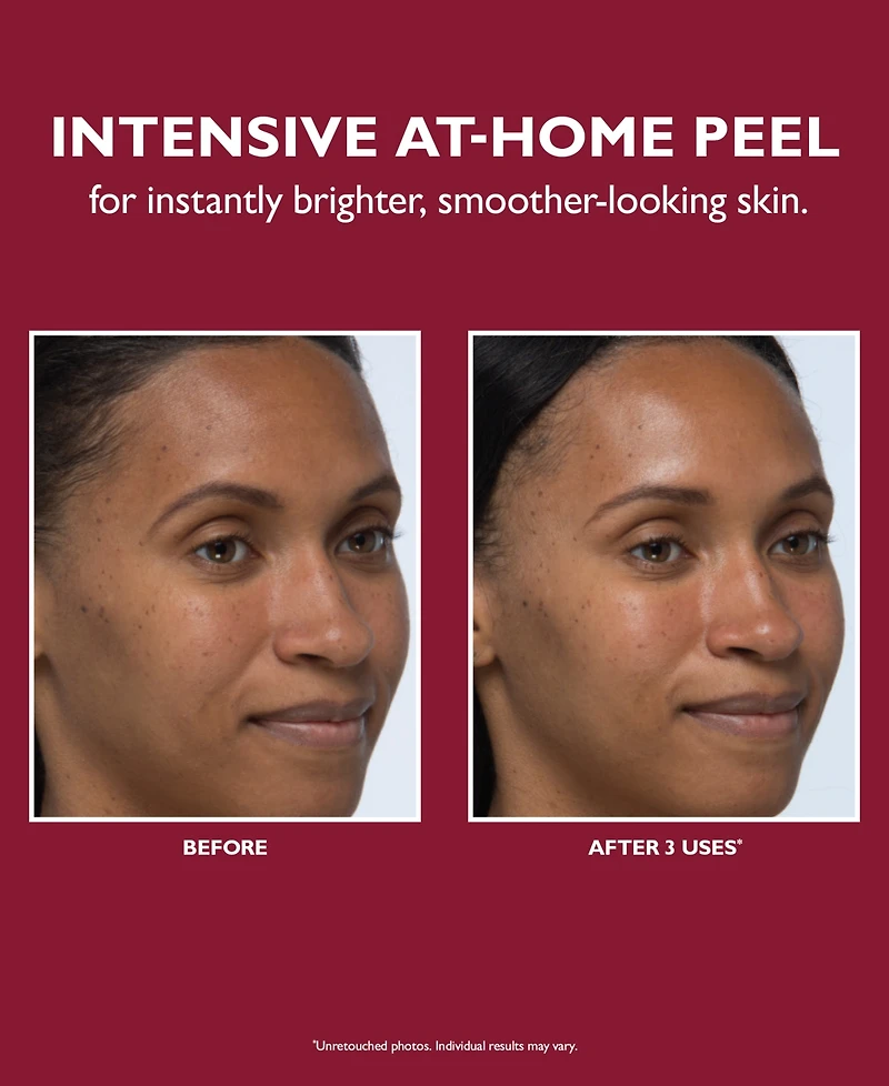 Peter Thomas Roth Even Smoother Instant Reveal Facial Peel, 8-Pk.