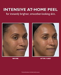 Peter Thomas Roth Even Smoother Instant Reveal Facial Peel, 8-Pk.