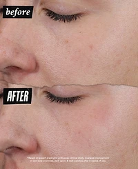 Kiehl's Since 1851 Auto-Tone Discoloration & Uv Solution, 1.4 oz.