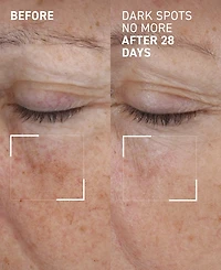 Dr. Brandt Dark Spots No More Triple Acid Spot Minimizing Concentrate, 0.5 oz.