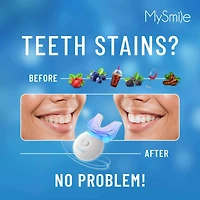 Two Original Teeth Whitening Kits