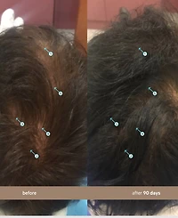 Ds Laboratories Spectral.dnc-n Hair Density Serum With Nanoxidil 5%, 60 ml