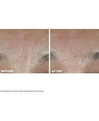 Clarins Total Eye Lift Eye Cream, 0.5 oz.