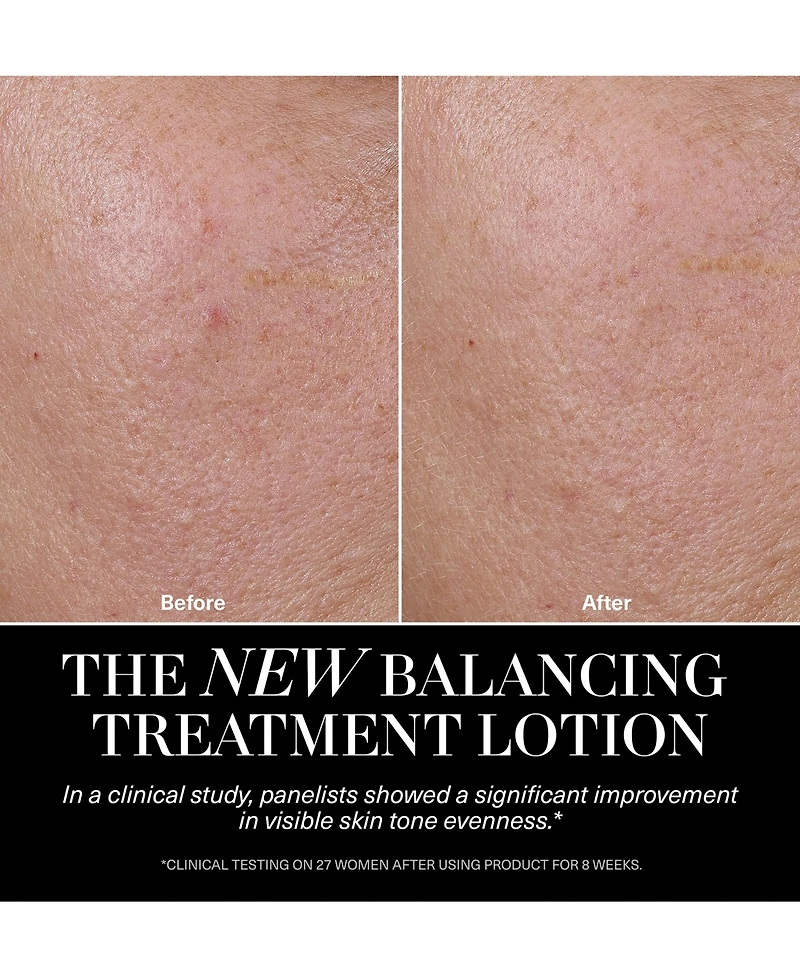 La Mer The Balancing Treatment Lotion, 5 oz.