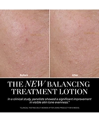La Mer The Balancing Treatment Lotion, 5 oz.