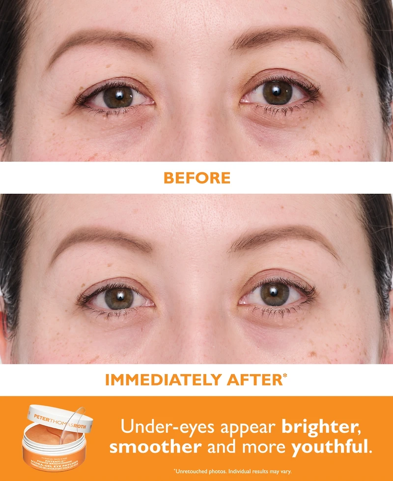 Peter Thomas Roth 2-Pc. Vitamin C and Hyaluronic Eye Patches Set
