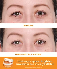 Peter Thomas Roth 2-Pc. Vitamin C and Hyaluronic Eye Patches Set