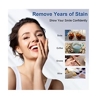 MySmile Teeth Whitening Kit with Led Light, 10 Min Fast Teeth Whitener, 35% Cp Teeth Whitening Gel