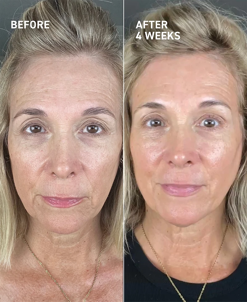 Dr. Brandt 2-Pc. Microneedling Recovery Kit