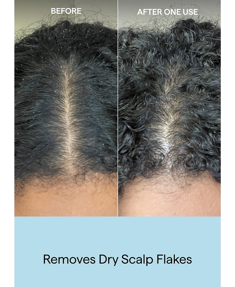 Briogeo Scalp Revival Charcoal + Coconut Oil Exfoliating Shampoo, 8 oz.