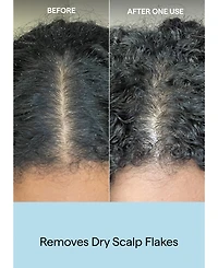 Briogeo Scalp Revival Charcoal + Coconut Oil Exfoliating Shampoo, 8 oz.