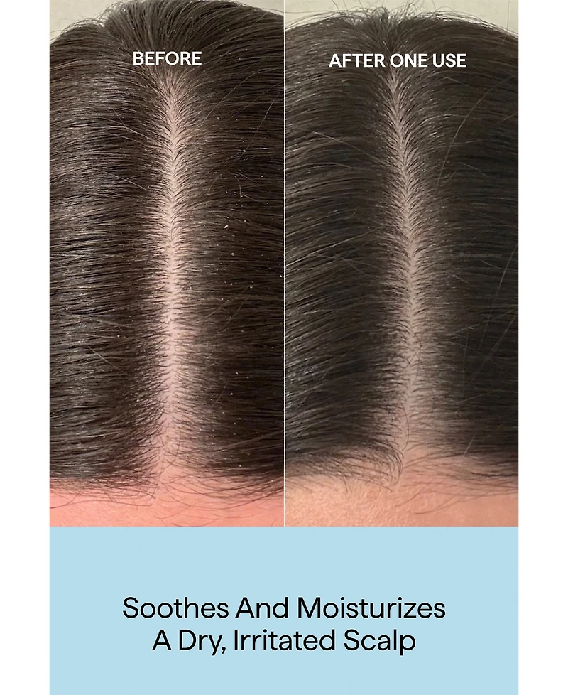 Briogeo Scalp Revival Rosemary Pre-Wash Oil, 3.4 oz.