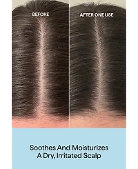 Briogeo Scalp Revival Rosemary Pre-Wash Oil, 3.4 oz.