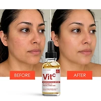 Dr. Botanicals Advanced Facial Serum 3 Percentage Vitamin C and Polyglutamic Acid 30milliliter