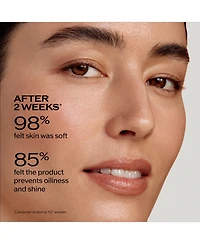 Shiseido Treatment Softener (For Normal and Combination to Oily Skin), 5 fl. oz.