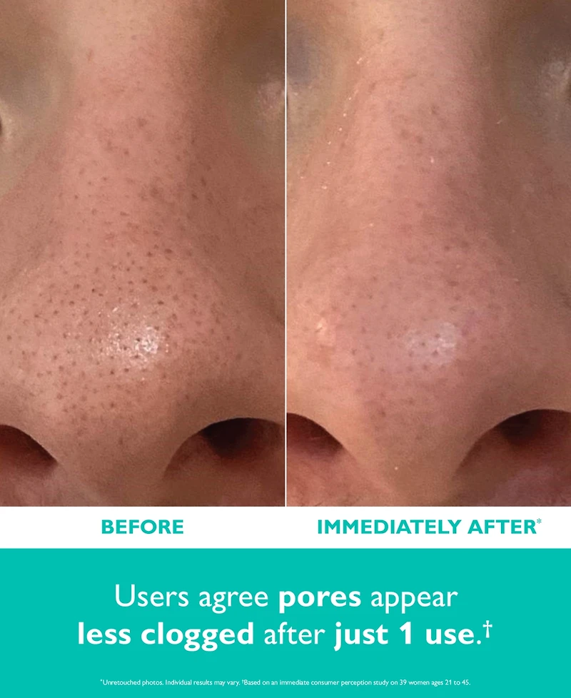 Peter Thomas Roth Even Smoother Microdermabrasion Exfoliating Pore Purifier, 1.7 oz.