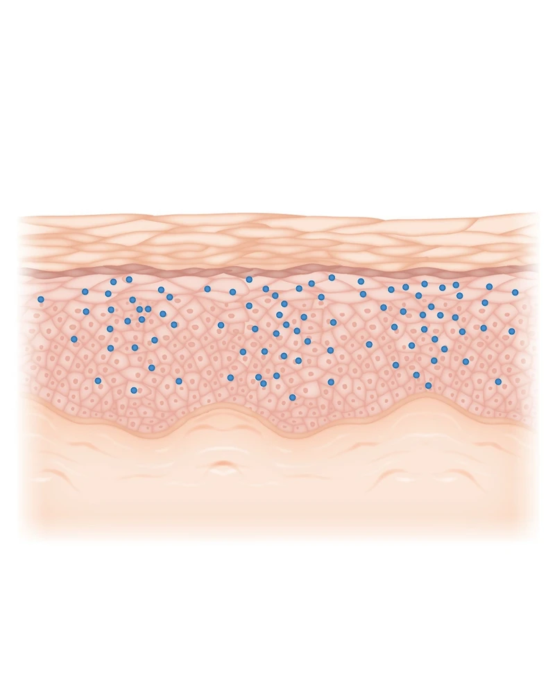 Women's Time Off Dissolving Hyaluronic Acid Microneedle Overnight Patch Treatment, 1 Month