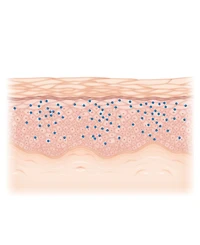 Women's Time Off Dissolving Hyaluronic Acid Microneedle Overnight Patch Treatment, 1 Month