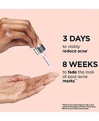 It Cosmetics Bye Bye Breakout Serum