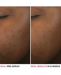 It Cosmetics Bye Bye Breakout Serum