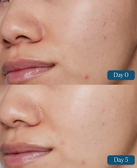 Elemis Dynamic Resurfacing Super-c Serum, 1 oz.