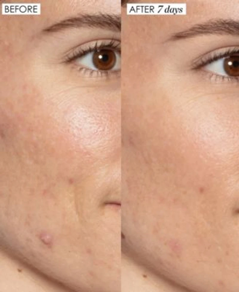 Sunday Riley Good Genes All In One Lactic Acid Treatment