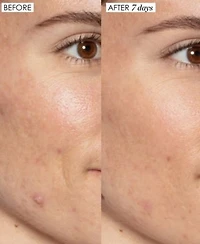 Sunday Riley Good Genes All In One Lactic Acid Treatment