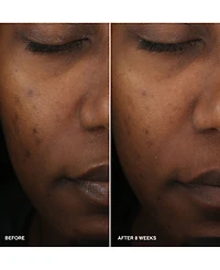 Bobbi Brown Vitamin Enriched Smoothing Niacinamide + Vitamin C Serum, 1 oz.