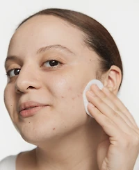 Clinique Acne Solutions Clarifying Face Lotion, 6.7 oz.