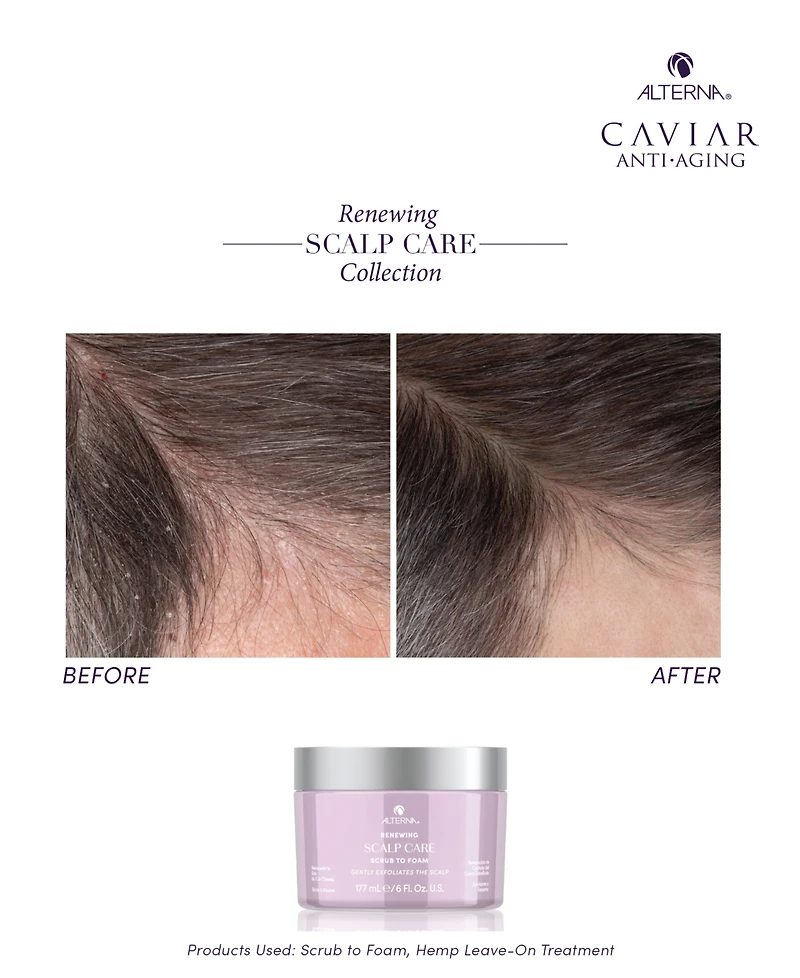 Alterna Renewing Scalp Care Scrub To Foam, 6 oz.