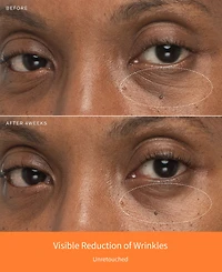 Sulwhasoo 4-Pc. First Care Trial Set