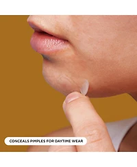 Night Hydrocolloid Everyday Pimple Patches – 224 Ct Mega Pack, Silk-Backed