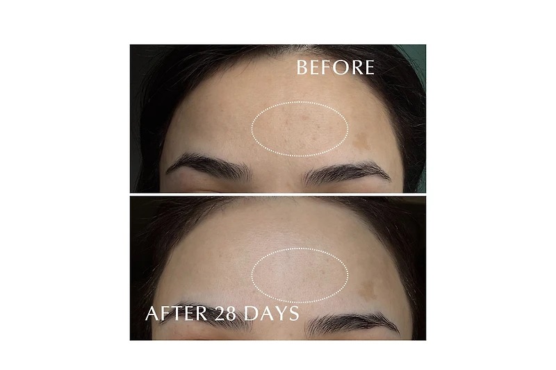 Albion Excia Brightening Immaculate Serum Z