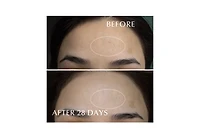 Albion Excia Brightening Immaculate Serum Z