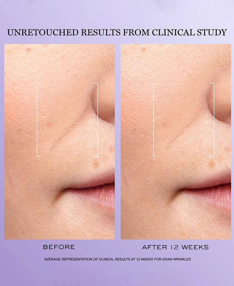 Lancome 3-Pc. Renergie H.c.f. Triple Serum Discovery Set