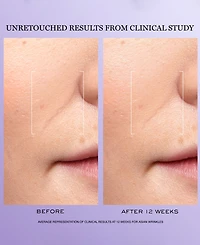 Lancome 3-Pc. Renergie H.c.f. Triple Serum Discovery Set