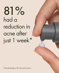 Origins Clear Improvement Acne Clearing Hydrating Lotion, 1.7 oz.