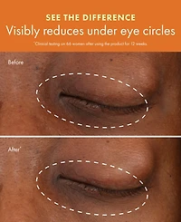 Origins GinZing Brightening Eye Cream with Vitamin C & Niacinamide