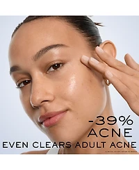 Lancome Clarifique Bx-Interceptor Acne Treatment, 1 oz.