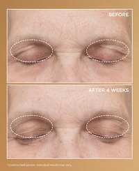 Perricone Md Neuropeptide Eyelid Lift Serum, 0.5 oz.